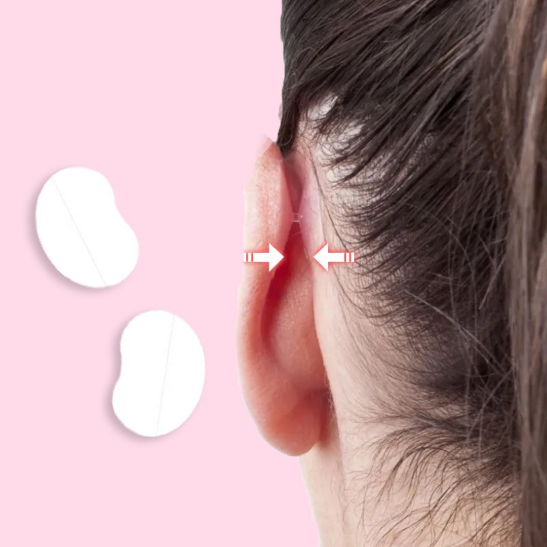 EarAlign ™ -  Comfortable Ear Shaping Patches